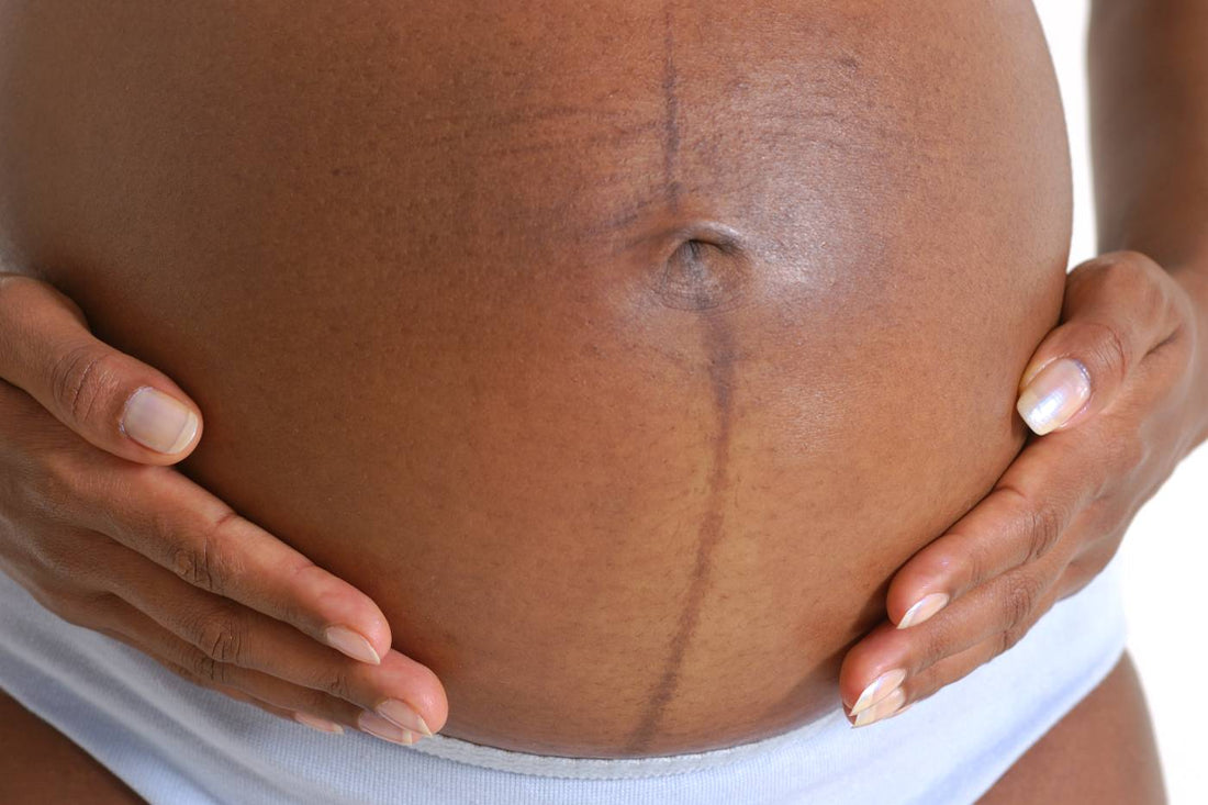 pregnancy line on baby bump